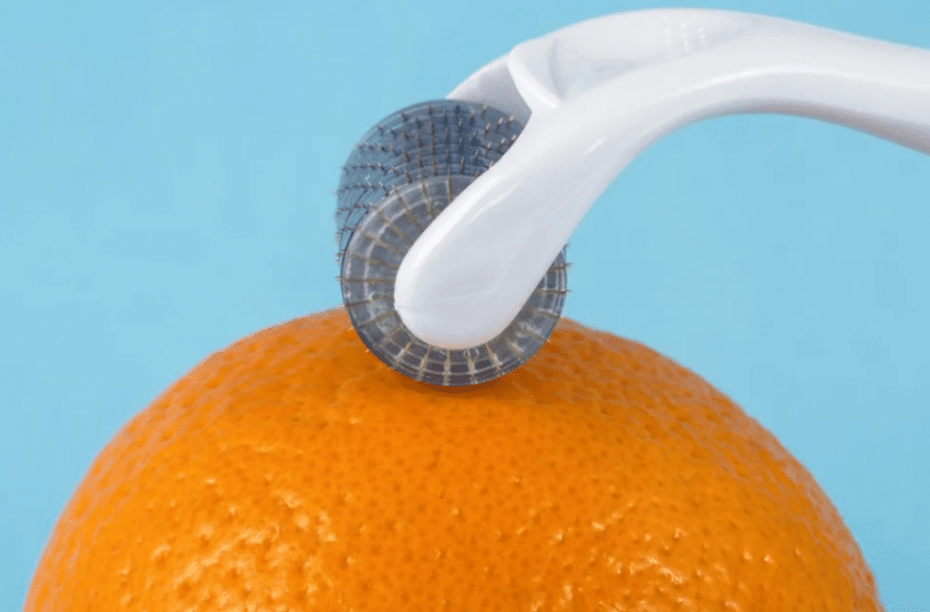  Cellulite e ritenzione idrica: no al grasso e alla buccia d’arancia!