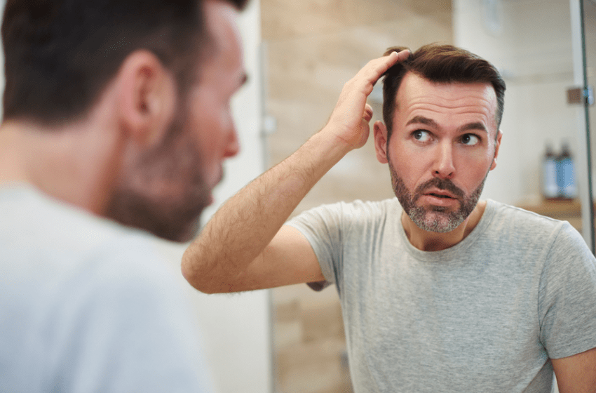  Caduta capelli nell’uomo? Le soluzioni 